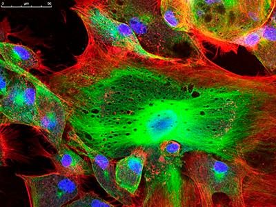 Cell Analysis Cell Analysis