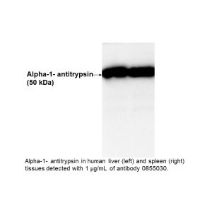 IgG Goat Anti-Human Alpha-1-Antitrypsin, 2 mL
