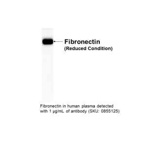 Anti-human fiberonectin, goat antiserum, 60.2mg/ml, 2 mL