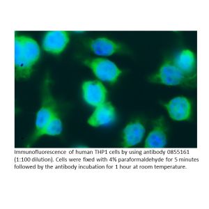 Anti-human lambda Light chain (Free Bence-Jones Protein) goat IgG fraction, fluorescein-conjugated, 2 mL