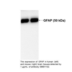 Anti-glial fibrillary acidic protein (GFAP) mouse monoclonal antibody
