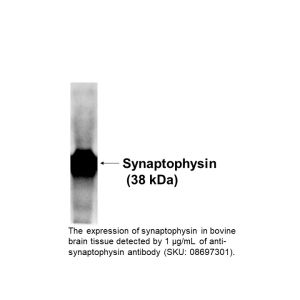 Anti-Synaptophysin IgG1 mouse monoclonal antibody (clone: SY38), 50 µg