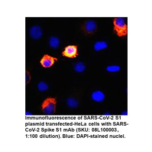 IFA of HeLa cell transfected with SAR-CoV-2 Spike S1 mAb