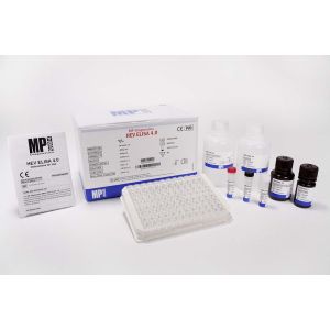 HEV ELISA 4.0 (CE)