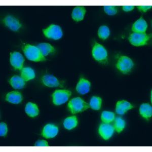 Immunofluorescence of Mouse J774A.1 Macrophage Cells
Antibody: goat anti-guinea pig C3
Dilution: 1:100 recommended (1:100-1:500)
Fixation: 4% paraformaldehyde 5 minutes room temperature
Antibody incubation: 1 hour at room temperature