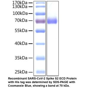 Recombinant SARS-CoV-2 Spike S2 ECD Protein with His tag