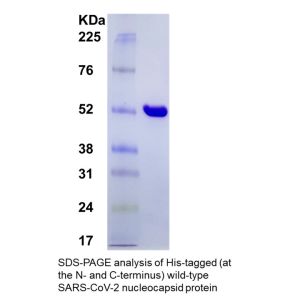 SARS-CoV-2 Nucleocapsid Protein, His tagged (E. coli)