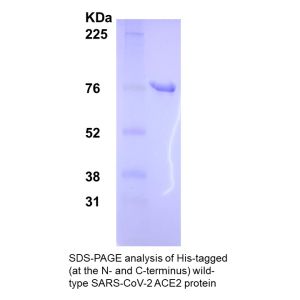 SDS-PAGE analysis of His-tagged (at the N-terminus and C-terminus) wild type SARS-CoV-2 ACE2 Protein