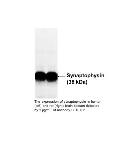 Anti-synaptophysin rabbit polyclonal antibody, 250 µL