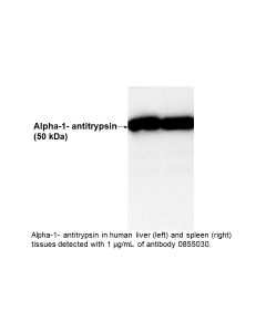 IgG Goat Anti-Human Alpha-1-Antitrypsin, 2 mL