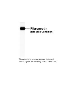 Goat anti-human fiberonectin, antiserum