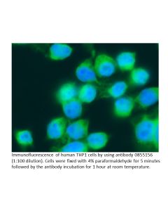 FITC IgG Goat Anti-Human Immunoglobulins (IgG, IgA, IgM), 2 mL