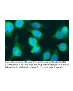 Anti-human lambda Light chain (Free Bence-Jones Protein) goat IgG fraction, fluorescein-conjugated, 2 mL