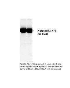 Mouse anti-epithelial keratin-AE5 monoclonal antibody, 200 µg