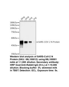 WB using SARS-CoV-2 N Protein Rabbit mAb