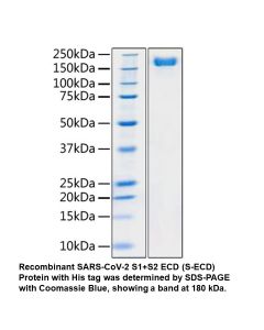 Recombinant SARS-CoV-2 S1+S2 ECD Protein (His tag, pre-fusion state)
