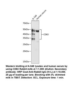 CD63 Rabbit Monoclonal Antibody