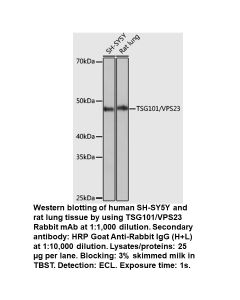 TSG101/VPS23 Rabbit Monoclonal Antibody
