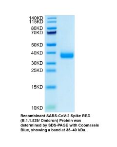Recombinant SARS-CoV-2 Spike RBD (B.1.1.529/Omicron) Protein (His tag)