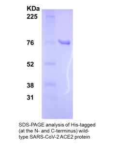 SDS-PAGE analysis of His-tagged (at the N-terminus and C-terminus) wild type SARS-CoV-2 ACE2 Protein