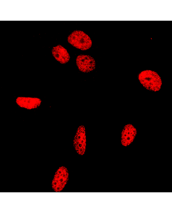 γH2AX Detection 560R