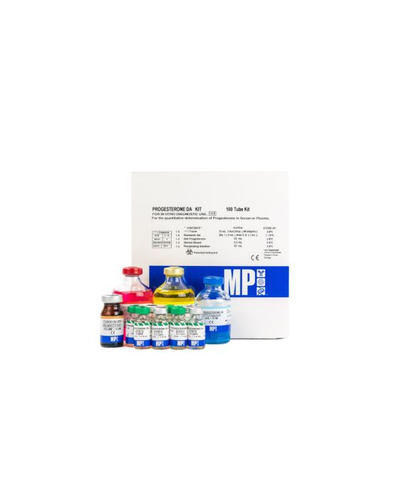 Progesterone Double Antibody RIA Kit