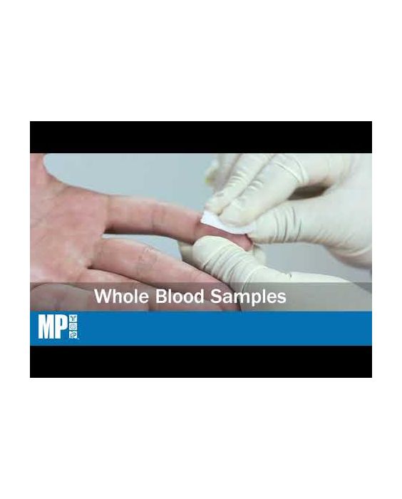 ASSURE TB Rapid Test (RUO)