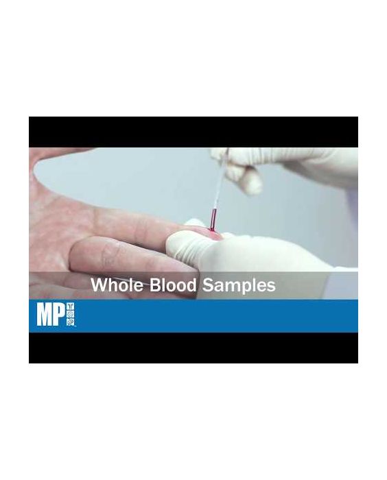 MULTISURE HCV Antibody Assay (RUO)