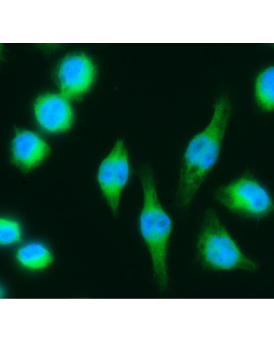 Immunofluorescence of Mouse J774A.1 Macrophage Cells Antibody: goat anti-human IGG Dilution: 1:100 recommended (1:100-1:500) Fixation: 4% paraformaldehyde 5 minutes room temperature Antibody incubation: 1 hour at room temperature 