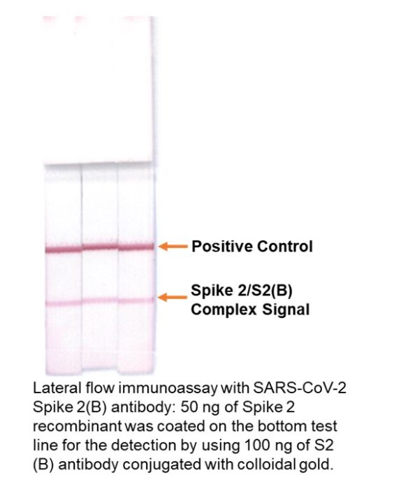 Anti-coronavirus-SARS-CoV-2-spike-S2-B-mouse-mAb