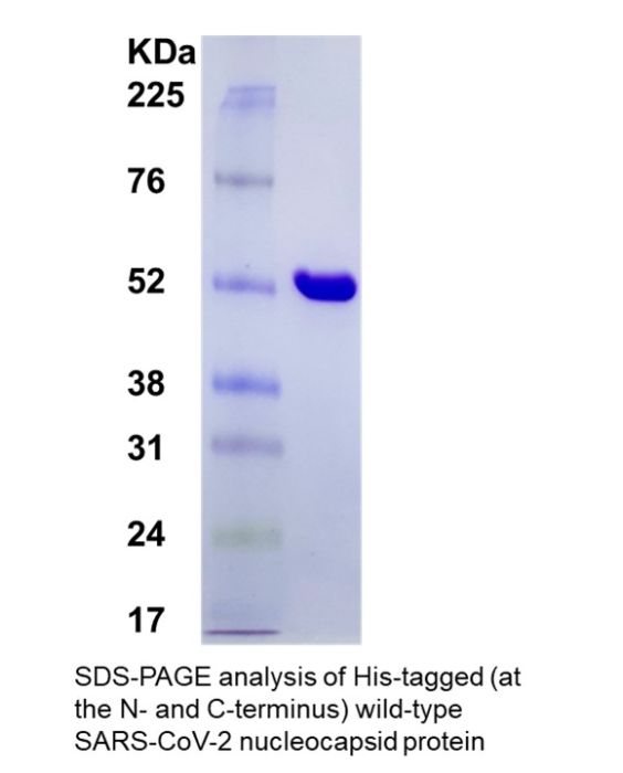 SARS-CoV-2 Nucleocapsid Protein, His tagged (E. coli)