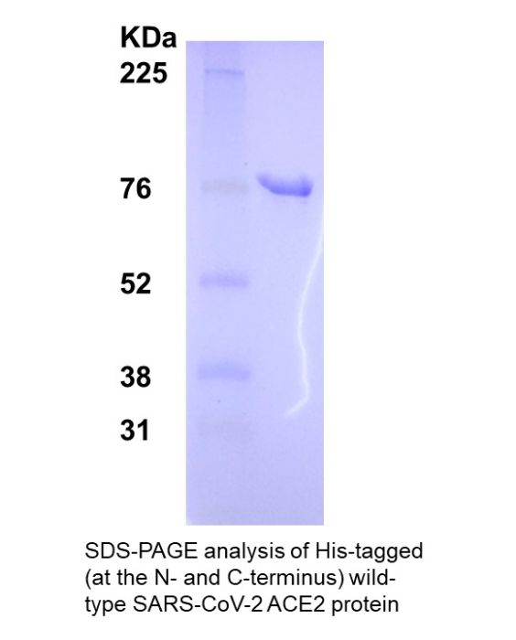 ACE2, His tag (E. coli)