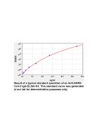 Human anti-SARS-CoV-2 IgM ELISA Kit, 96 Tests