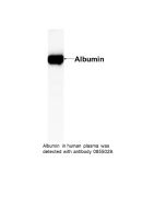 IgG Rabbit Anti-Human Albumin, 2 mL