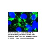 Anti-human albumin goat IgG fraction, fluorescein-conjugated, 2 mL