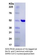 SARS-CoV-2 Nucleocapsid Protein, His tagged (<em>E. coli</em>)