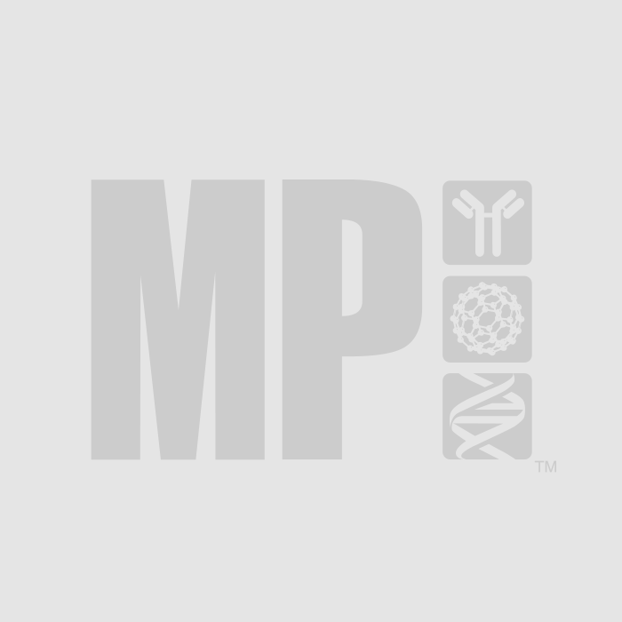 Custom Peptide Synthesis