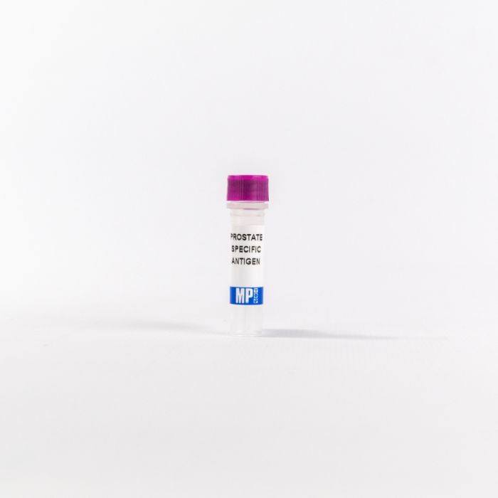 Prostate Specific Antigen