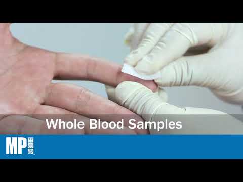 ASSURE TB Rapid Test
