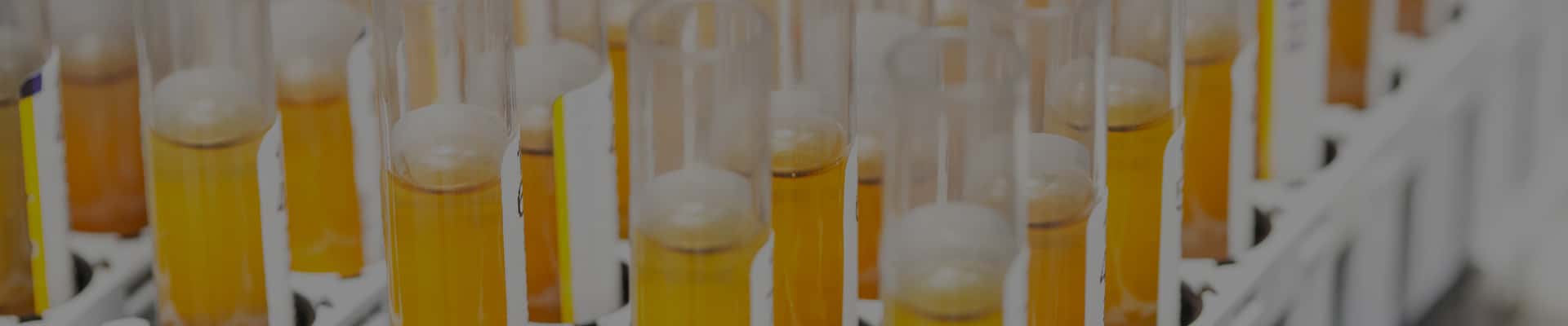 Overview of Rancidity Test Methods