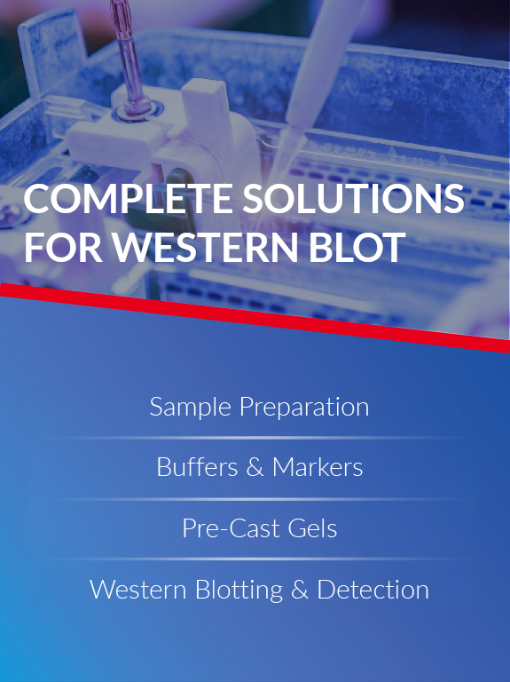 MP Biomedicals Precast gel and western blot solutions