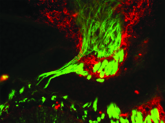 Immunohistochemistry (IHC) Reagents