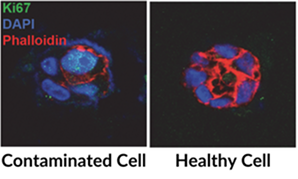 Contaminated cell vs healthy cell micro-imaging