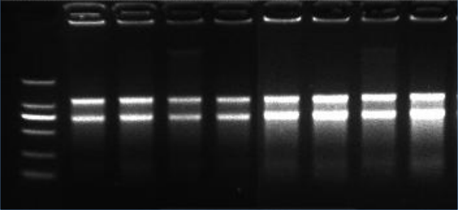 Gel electrophoresis image of total RNA extracted from 20 mg and 5 mg of chicken liver