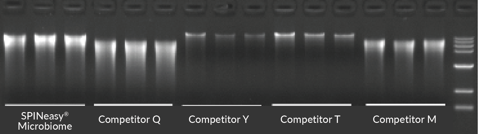 DNA gel image displaying DNA extracted from 1 mL BALF using SPINeasy DNA Kit for Microbiome and competitor kits