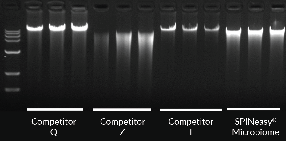Gel electrophoresis image displaying DNA extracted from 200 µL of human whole blood spiked with 10 µL of bacterial solution using Lysing Matrix E. SPINeasy DNA Kit for Microbiome yielded the highest DNA quantity and maintained good integrity compared to competitor kits