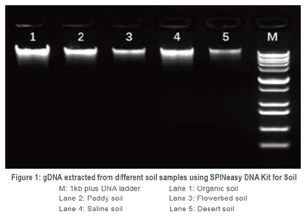 Overcome the problems of DNA extraction from soil samples with high ...