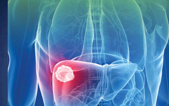 Tumor Markers Tumor Markers